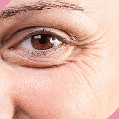 Botox